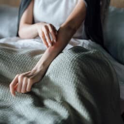 Woman with allergies scratches arm
