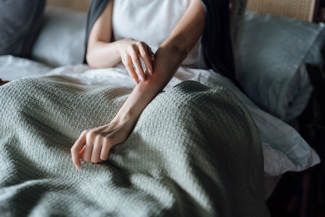 Woman with allergies scratches arm
